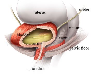 Bladder retraining