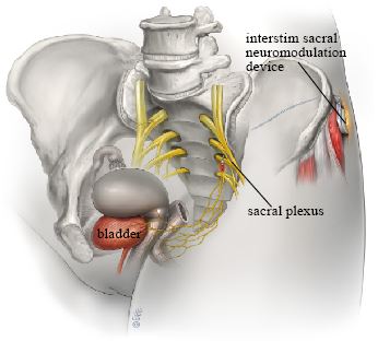 Fecal Incontinence