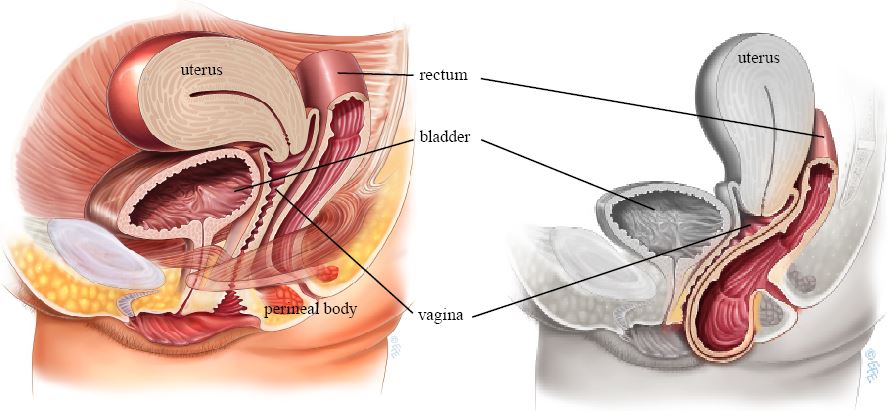 Posterior repair