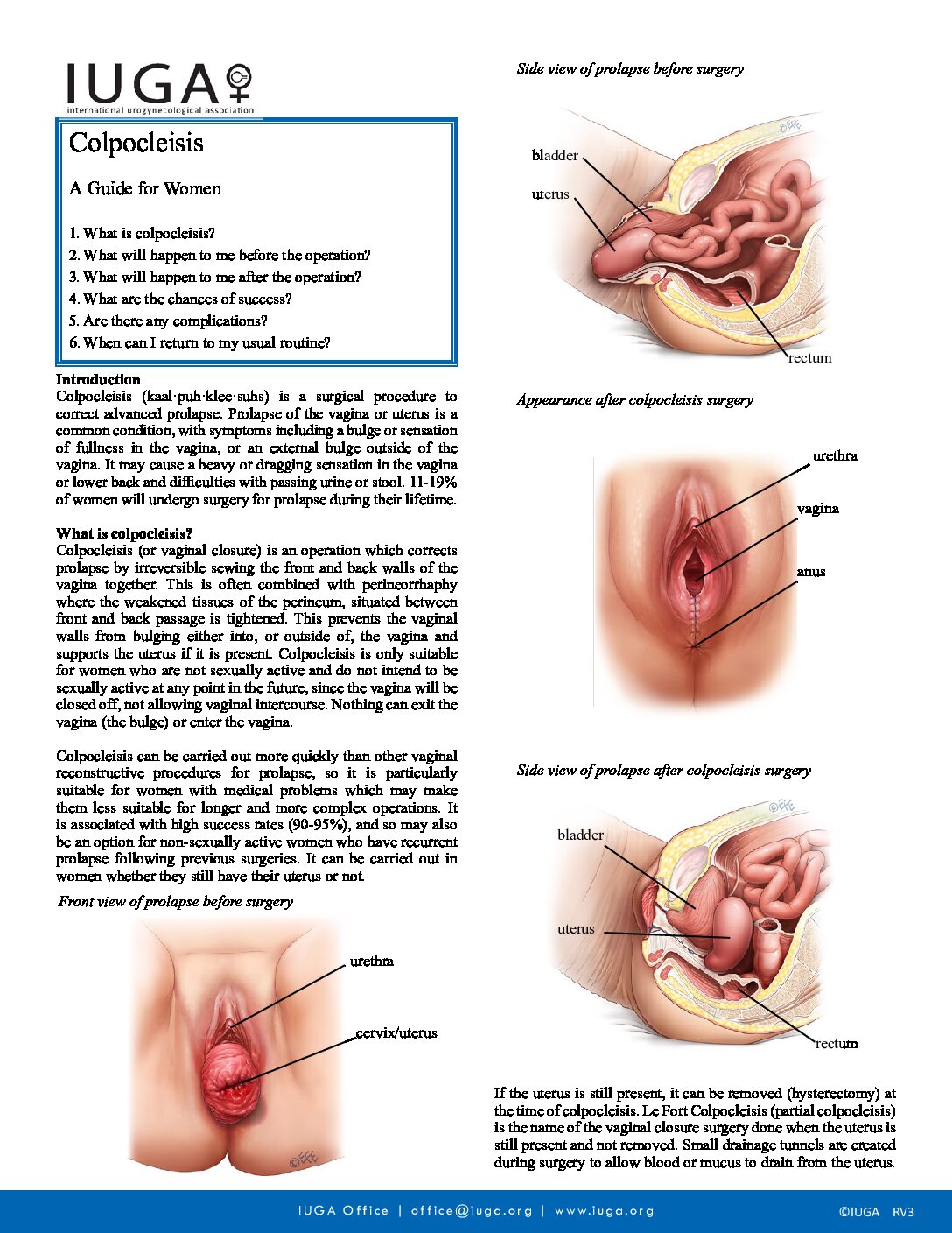 International Urogynecological Association (IUGA)