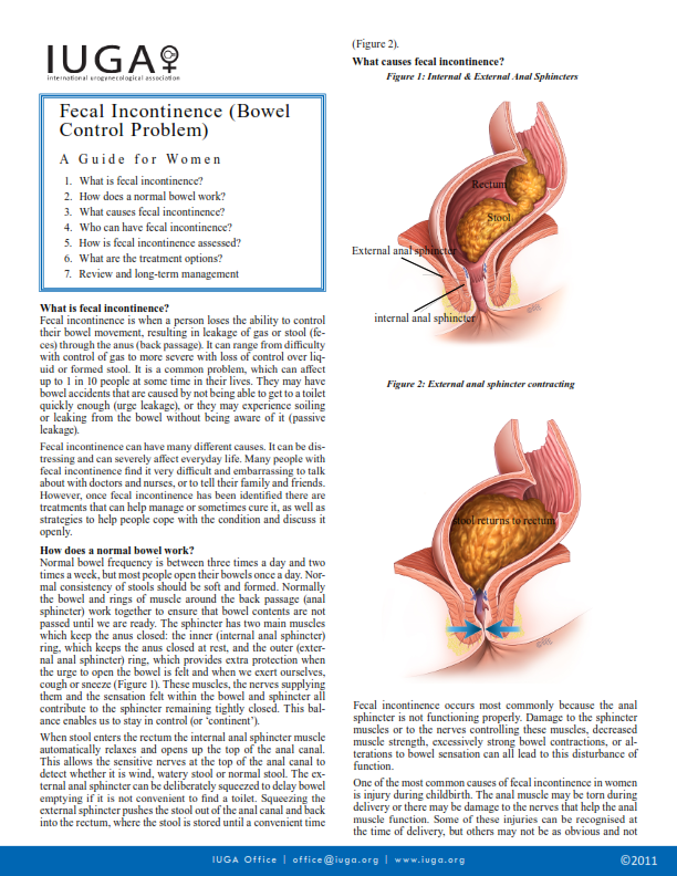 Fecal-Incontinence - Your Pelvic Floor