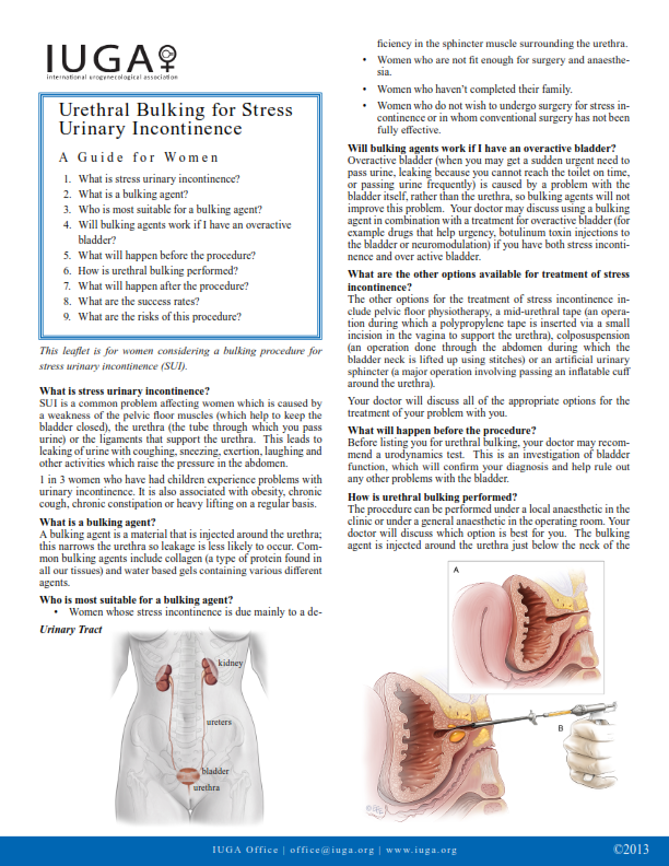 Urethral Bulking for Stress Urinary Incontinence