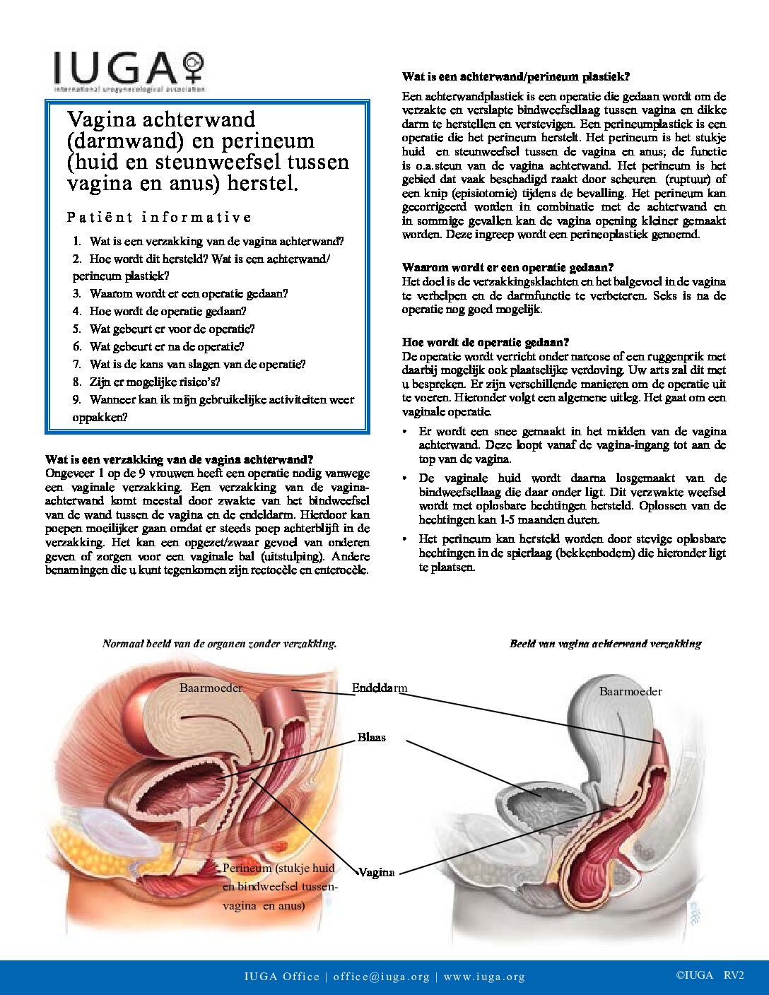 posterior-vaginal-wall-and-perineal-body-repair-dutch - Your Pelvic Floor